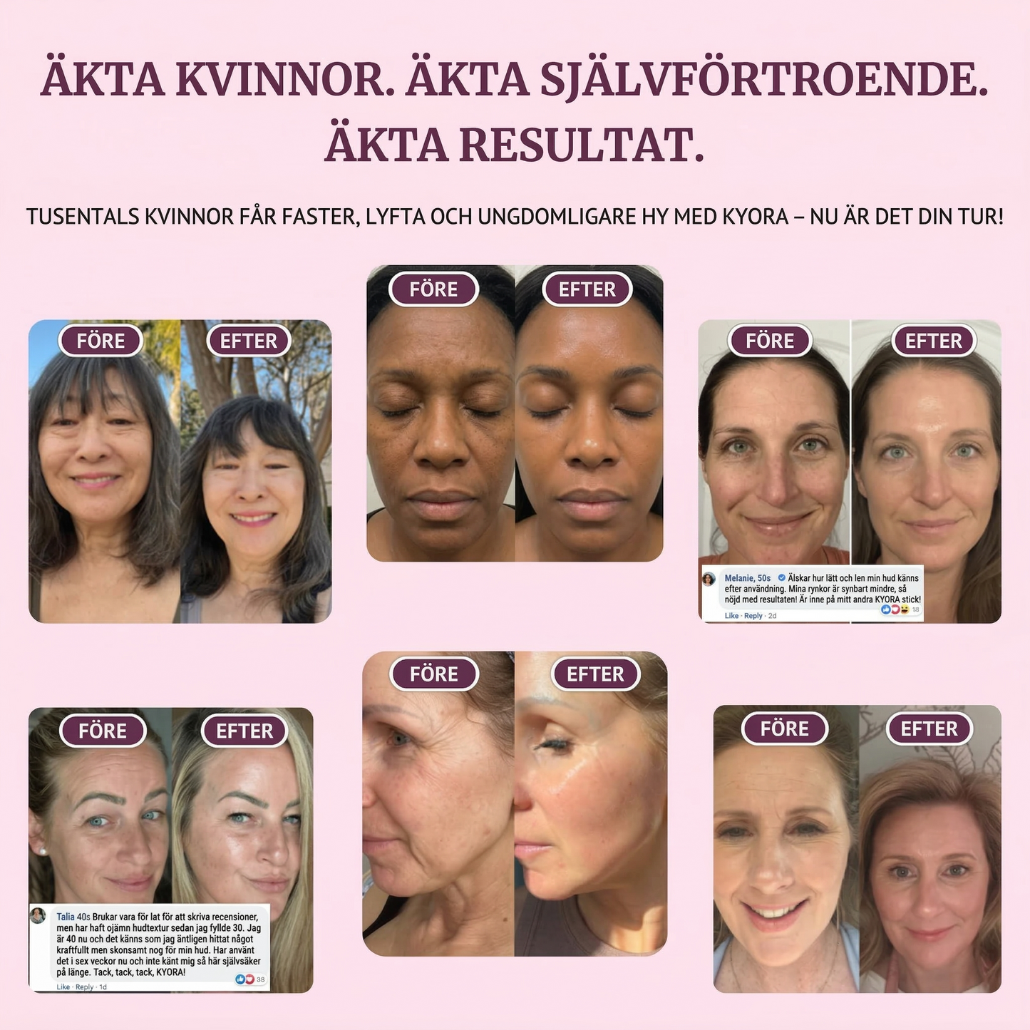 Kyora K-Beauty balm