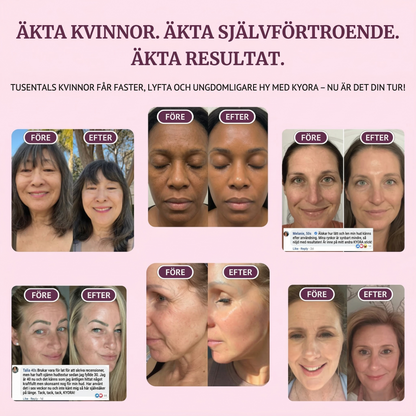 Kyora K-Beauty balm