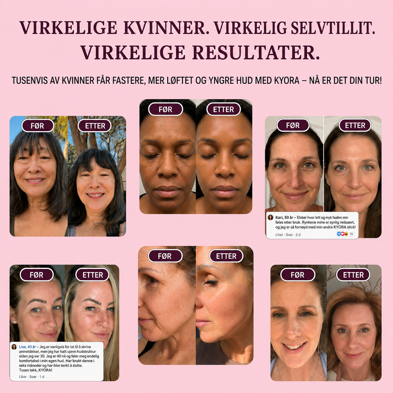 Kyora K-beauty Balm nr.