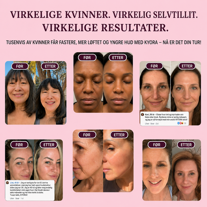 Kyora K-beauty Balm nr.